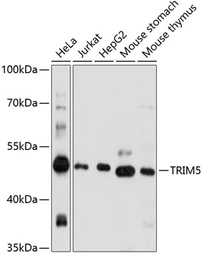Anti-TRIM5 antibody used in Western Blot (WB). GTX66410