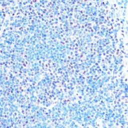 Anti-SNRPB antibody used in IHC (Paraffin sections) (IHC-P). GTX66411