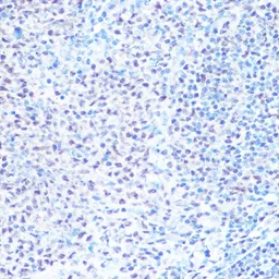 Anti-SNRPB antibody used in IHC (Paraffin sections) (IHC-P). GTX66411