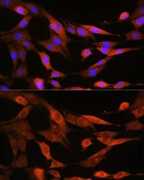 Anti-ASS1 antibody used in Immunocytochemistry/ Immunofluorescence (ICC/IF). GTX66412