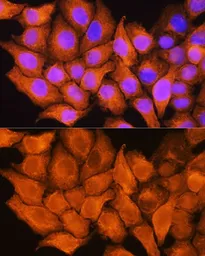 Anti-ASS1 antibody used in Immunocytochemistry/ Immunofluorescence (ICC/IF). GTX66412
