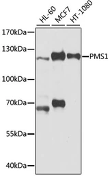 Anti-PMS1 antibody used in Western Blot (WB). GTX66414
