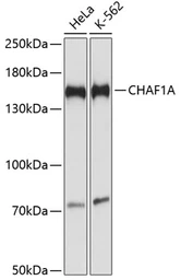 Anti-CHAF1A antibody used in Western Blot (WB). GTX66415