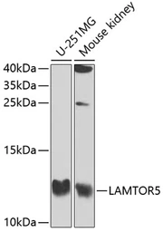 Anti-HBXIP antibody used in Western Blot (WB). GTX66417