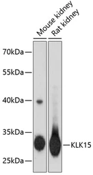 Anti-Kallikrein 15 antibody used in Western Blot (WB). GTX66419