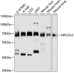 Anti-NPL4 antibody used in Western Blot (WB). GTX66423