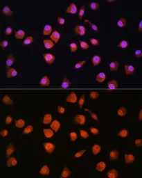 Anti-NPL4 antibody used in Immunocytochemistry/ Immunofluorescence (ICC/IF). GTX66423