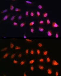 Anti-NPL4 antibody used in Immunocytochemistry/ Immunofluorescence (ICC/IF). GTX66423