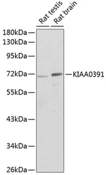 Anti-KIAA0391 antibody used in Western Blot (WB). GTX66424