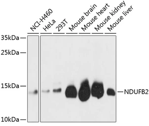 Anti-NDUFB2 antibody used in Western Blot (WB). GTX66430