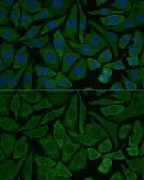 Anti-NDUFB2 antibody used in Immunocytochemistry/ Immunofluorescence (ICC/IF). GTX66430
