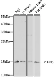 Anti-Prefoldin 5 antibody used in Western Blot (WB). GTX66432