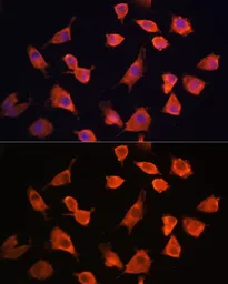 Anti-Prefoldin 5 antibody used in Immunocytochemistry/ Immunofluorescence (ICC/IF). GTX66432
