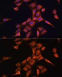 Anti-Prefoldin 5 antibody used in Immunocytochemistry/ Immunofluorescence (ICC/IF). GTX66432