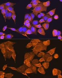 Anti-Prefoldin 5 antibody used in Immunocytochemistry/ Immunofluorescence (ICC/IF). GTX66432
