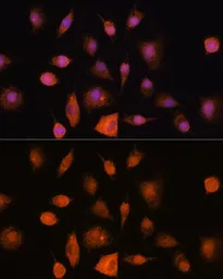 Anti-Ribonuclease Inhibitor antibody used in Immunocytochemistry/ Immunofluorescence (ICC/IF). GTX66433