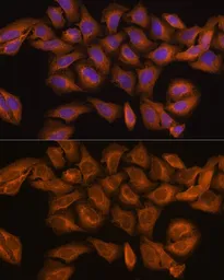 Anti-Ribonuclease Inhibitor antibody used in Immunocytochemistry/ Immunofluorescence (ICC/IF). GTX66433