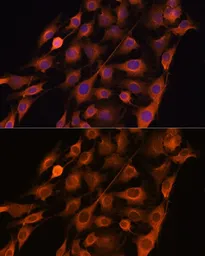 Anti-Ribonuclease Inhibitor antibody used in Immunocytochemistry/ Immunofluorescence (ICC/IF). GTX66433