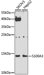 Anti-S100A3 antibody used in Western Blot (WB). GTX66434