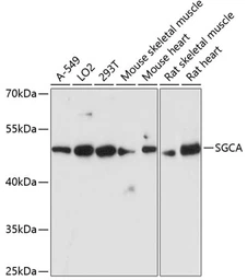 Anti-alpha Sarcoglycan antibody used in Western Blot (WB). GTX66435