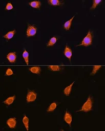 Anti-alpha Sarcoglycan antibody used in Immunocytochemistry/ Immunofluorescence (ICC/IF). GTX66435