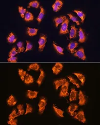Anti-alpha Sarcoglycan antibody used in Immunocytochemistry/ Immunofluorescence (ICC/IF). GTX66435
