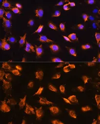 Anti-alpha Sarcoglycan antibody used in Immunocytochemistry/ Immunofluorescence (ICC/IF). GTX66435