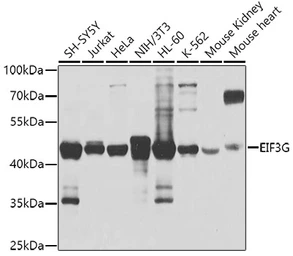 Anti-EIF3G antibody used in Western Blot (WB). GTX66437