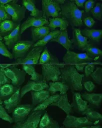 Anti-EIF3G antibody used in Immunocytochemistry/ Immunofluorescence (ICC/IF). GTX66437