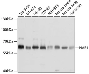 Anti-APPBP1 antibody used in Western Blot (WB). GTX66438