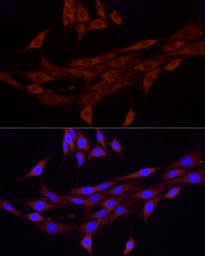 Anti-FAM38A antibody used in Immunocytochemistry/ Immunofluorescence (ICC/IF). GTX66441