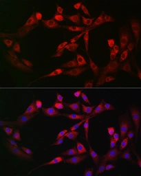 Anti-FAM38A antibody used in Immunocytochemistry/ Immunofluorescence (ICC/IF). GTX66441