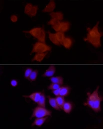 Anti-FAM38A antibody used in Immunocytochemistry/ Immunofluorescence (ICC/IF). GTX66441