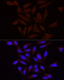 Anti-FAM38A antibody used in Immunocytochemistry/ Immunofluorescence (ICC/IF). GTX66441