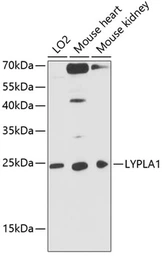 Anti-LYPLA1 antibody used in Western Blot (WB). GTX66442