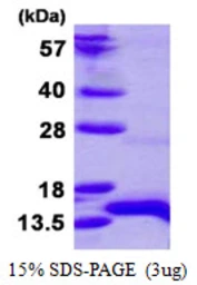 Human HOPX protein, His tag. GTX66445-pro