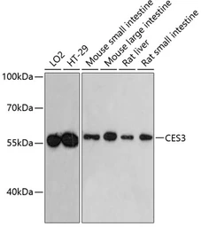 Anti-CES3 antibody used in Western Blot (WB). GTX66446