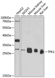 Anti-TPK1 antibody used in Western Blot (WB). GTX66448