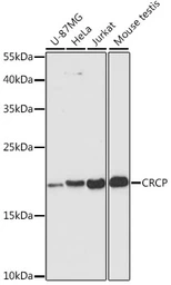 Anti-CRCP antibody used in Western Blot (WB). GTX66450