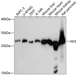 Anti-AK3 antibody used in Western Blot (WB). GTX66453