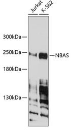 Anti-NBAS antibody used in Western Blot (WB). GTX66454