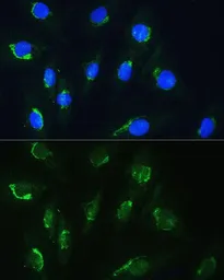 Anti-NBAS antibody used in Immunocytochemistry/ Immunofluorescence (ICC/IF). GTX66454