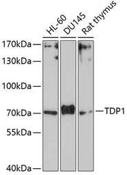 Anti-TDP1 antibody used in Western Blot (WB). GTX66457