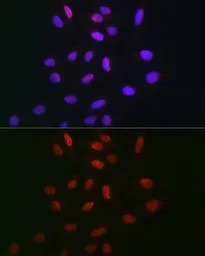 Anti-TDP1 antibody used in Immunocytochemistry/ Immunofluorescence (ICC/IF). GTX66457