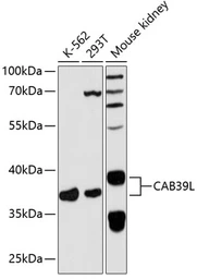 Anti-CAB39L antibody used in Western Blot (WB). GTX66461