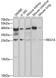 Anti-REG1A antibody used in Western Blot (WB). GTX66464