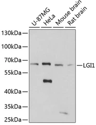 Anti-LGI1 antibody used in Western Blot (WB). GTX66465