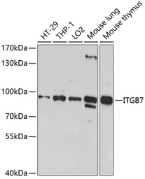 Anti-Integrin beta 7 antibody used in Western Blot (WB). GTX66467