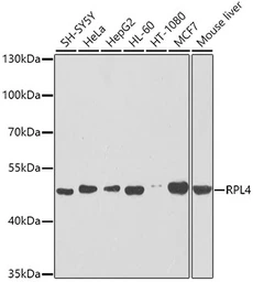 Anti-RPL4 antibody used in Western Blot (WB). GTX66468