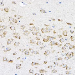 Anti-RPL4 antibody used in IHC (Paraffin sections) (IHC-P). GTX66468